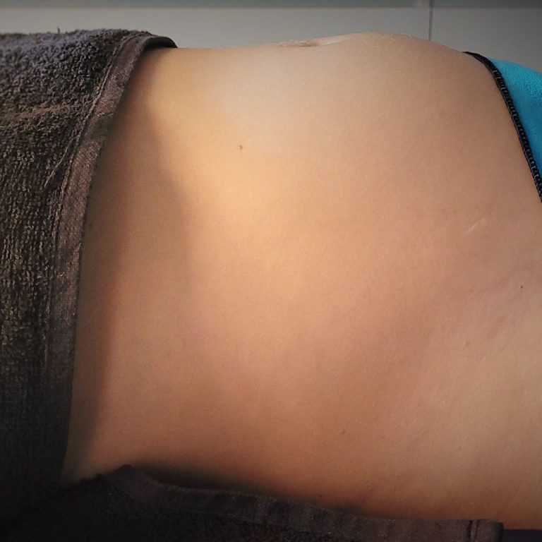 drainage lymphatique Antibes élimine la cellulite Cannes